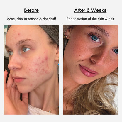 Skin Glow™ Complete (GHK-CU)